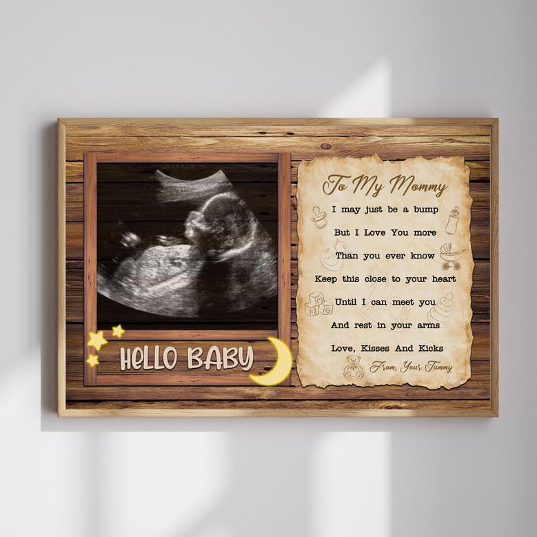 Personalized Ultrasound Canvas for New Mom – A Heartfelt Gift for Mommy-to-Be | Familywalldecor AU