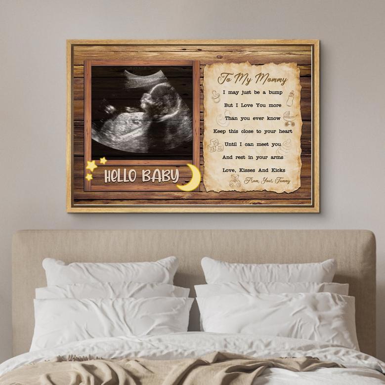 Personalized Ultrasound Canvas for New Mom – A Heartfelt Gift for Mommy-to-Be