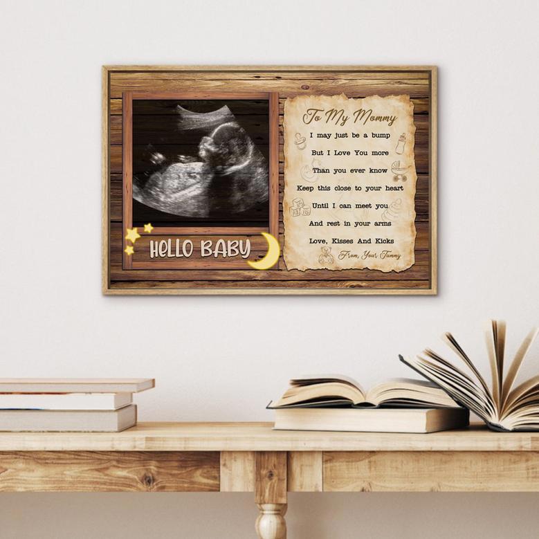 Personalized Ultrasound Canvas for New Mom – A Heartfelt Gift for Mommy-to-Be