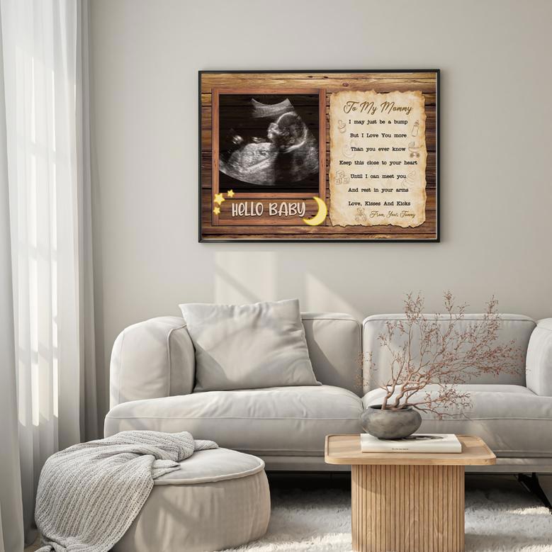 Personalized Ultrasound Canvas for New Mom – A Heartfelt Gift for Mommy-to-Be